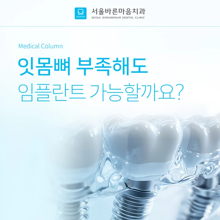 뼈이식 임플란트, 잇몸뼈가 부족해도 가능한 이유 | 전문의가 알려드리는 과정과 종류 | 서울바른마음치과의원