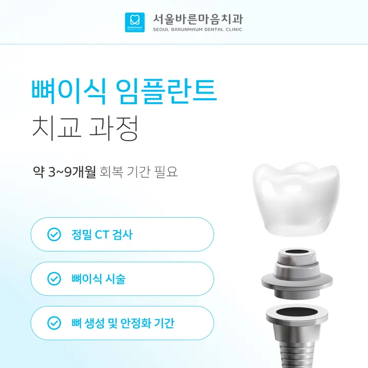 치아교정, 성인도 늦지 않은 이유