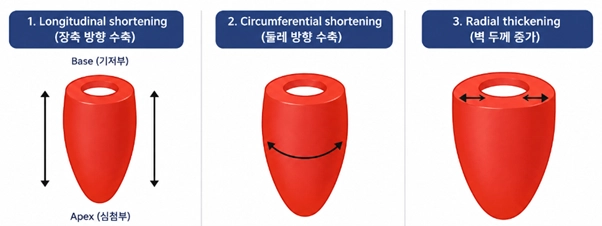 심장 수축력 지표 해석