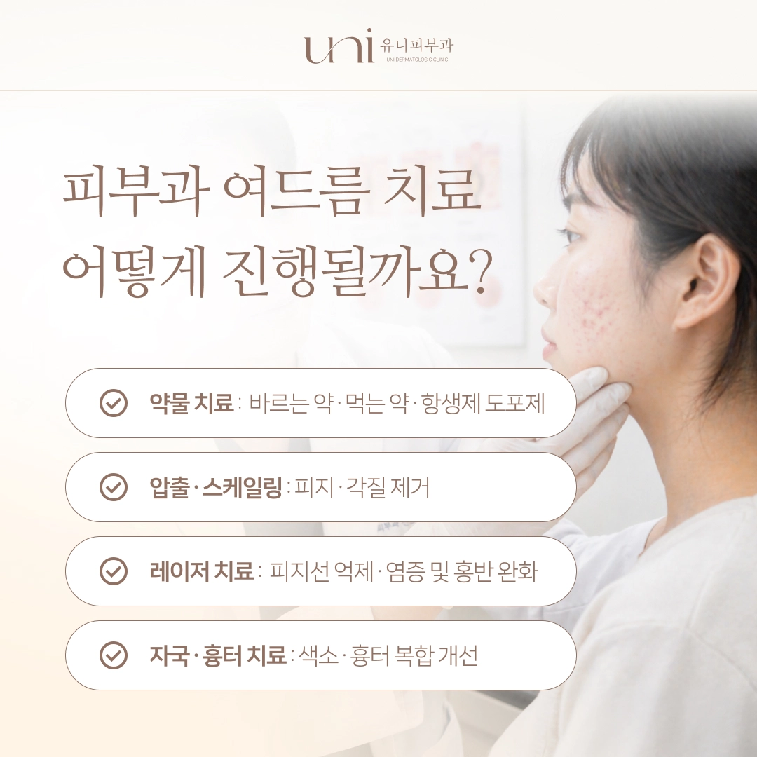 피부과 여드름 치료 — 약물·압출·레이저 시술 과정